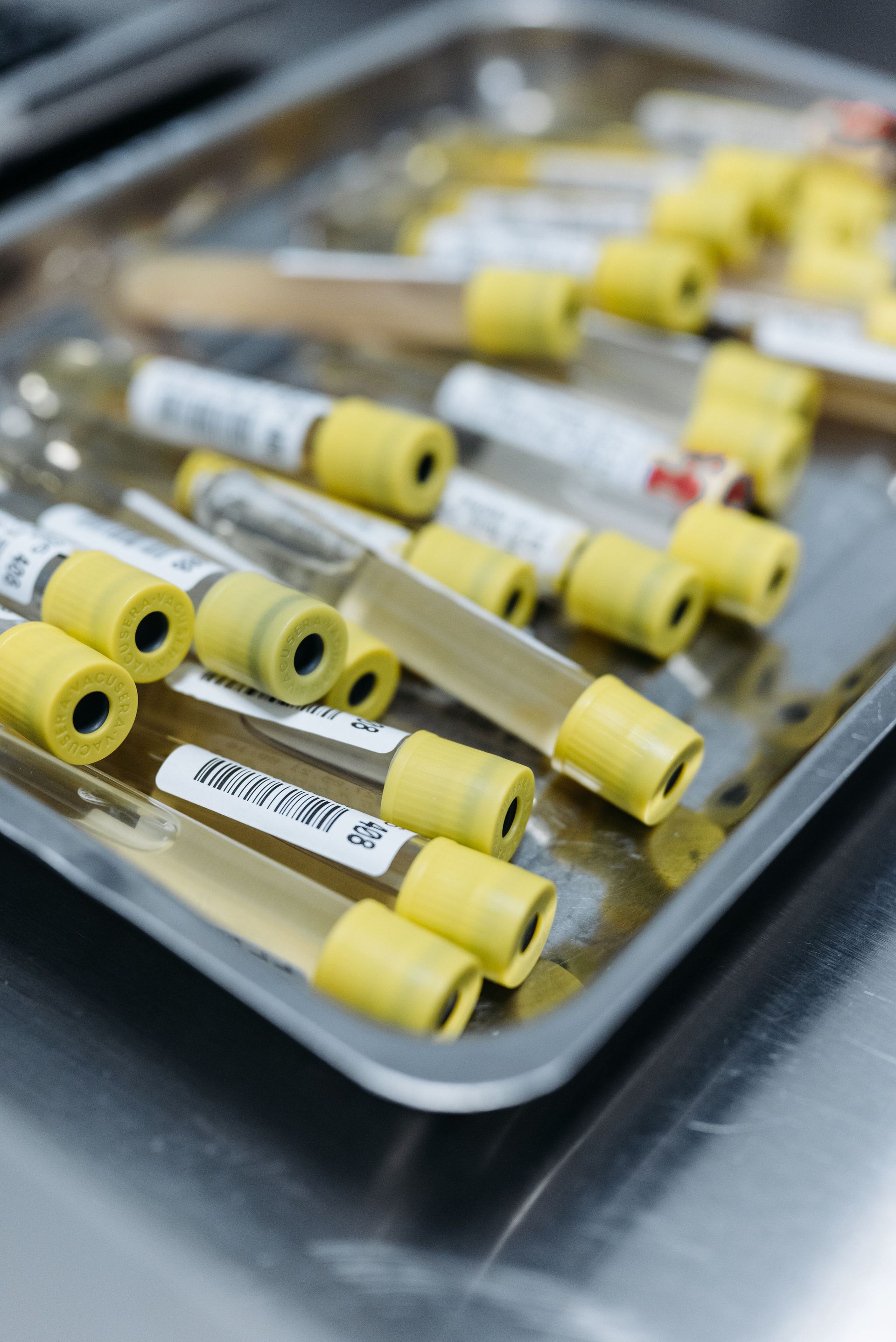 A close-up of laboratory vials with yellow caps used for scientific research.